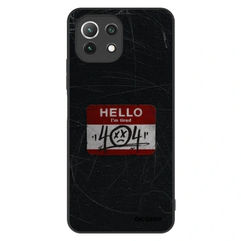 Maskica za Xiaomi 11 Lite 5G NE - HELLO 404