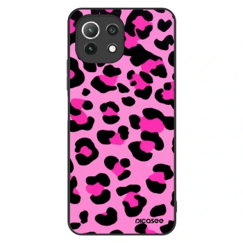 Maskica za Xiaomi Mi 11 Lite - Pink Tiger