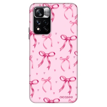 Maskica za Xiaomi Redmi Note 11 Pro - Bow Aesthetic