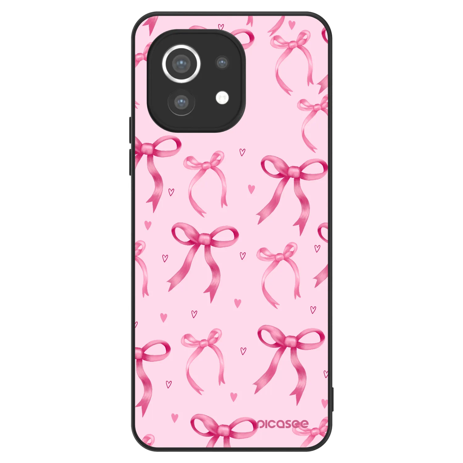 Picasee ULTIMATE CASE za Xiaomi Mi 11 - Bow Aesthetic