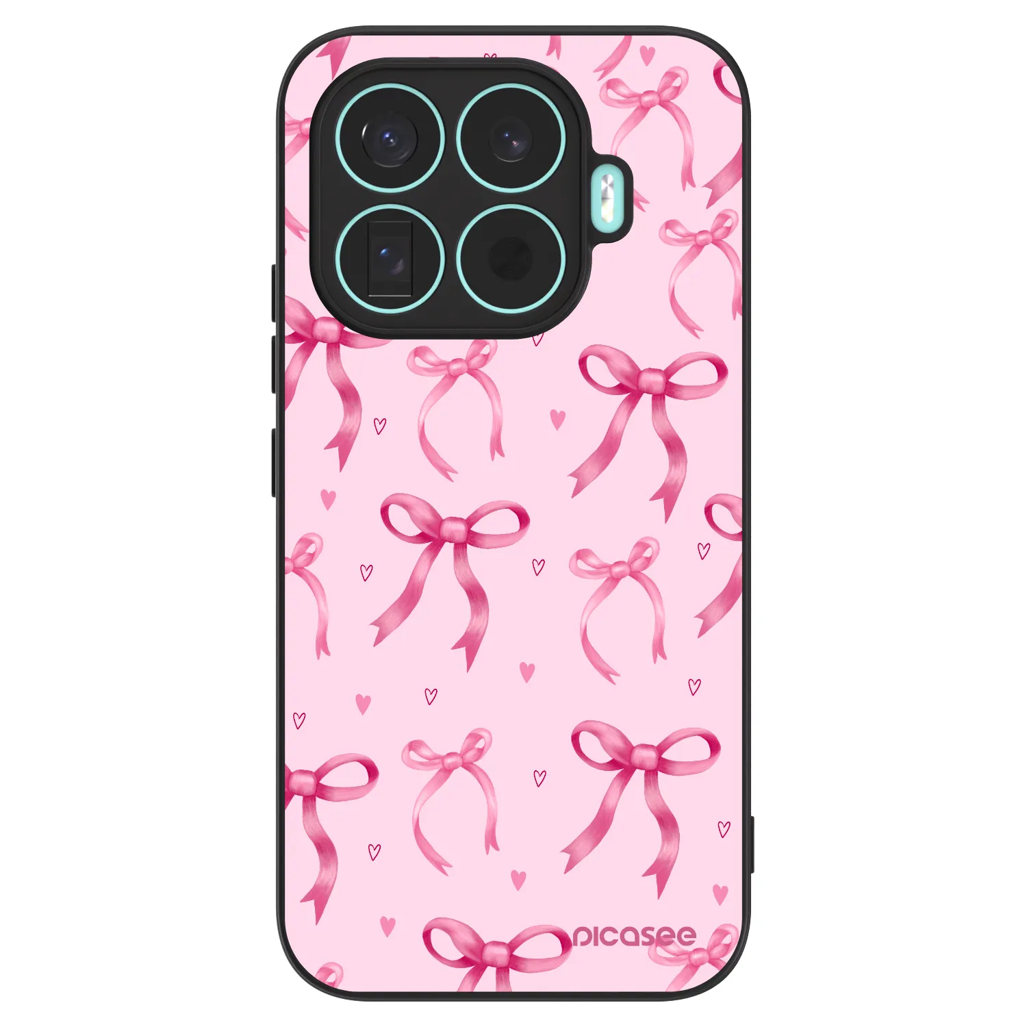 Picasee ULTIMATE CASE za Xiaomi 17T - Bow Aesthetic