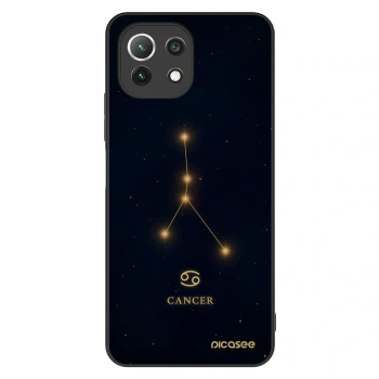 Maskica za Xiaomi Mi 11 Lite - CANCER