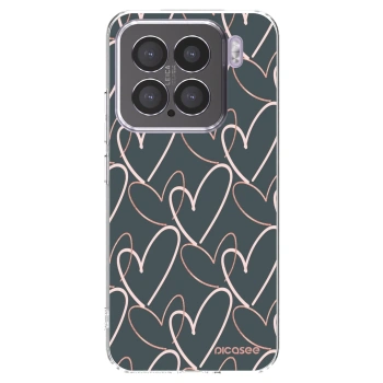 Picasee silikonska prozirna maskica za Xiaomi 15 - Lots of love